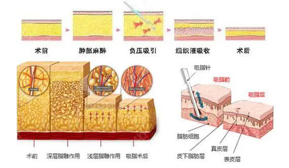 图片1.png 图片1.png